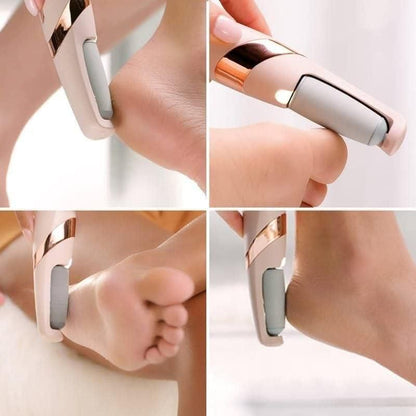Foot Callus Remover